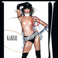 Karlie Kloss : Photoshop lui fait pousser des aisselles (Photos)
