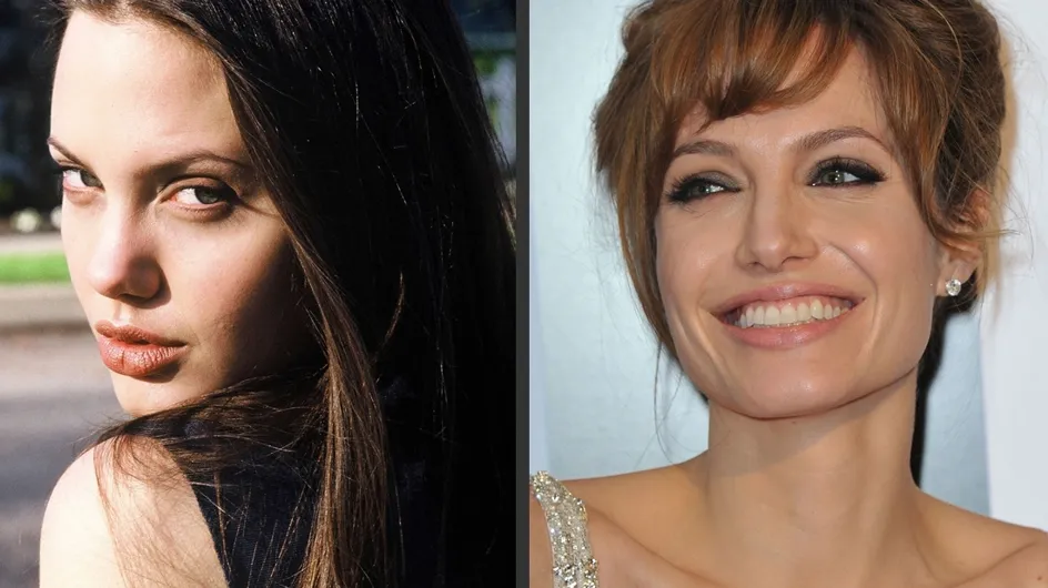 Angelina Jolie et la chirurgie esthétique : Son avant/après en photos