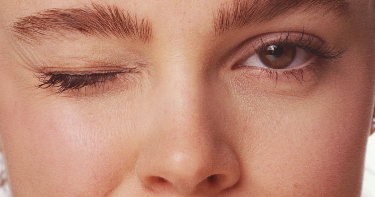 Cligner des yeux L
