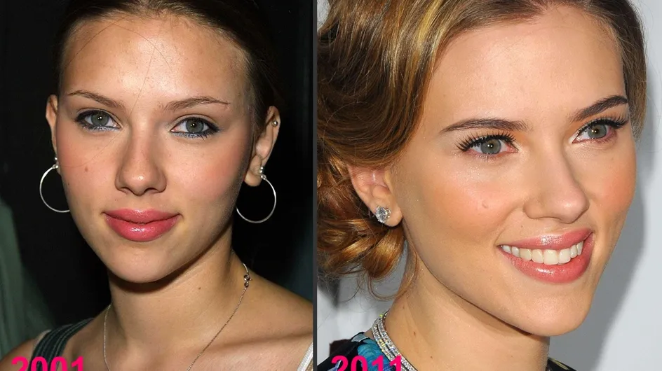 Scarlett Johansson et la chirurgie esthétique : Son avant/après en photos