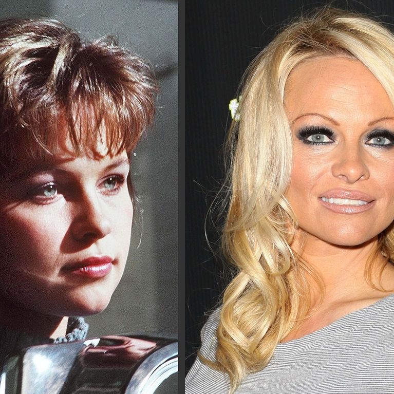 Pamela Anderson et la chirurgie esthétique Son avant/après en photos