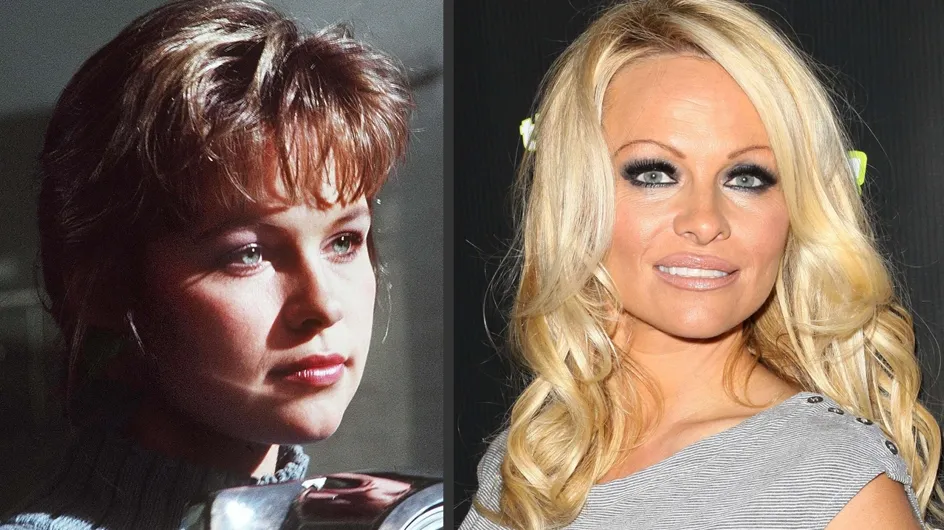 Pamela Anderson et la chirurgie esthétique : Son avant/après en photos