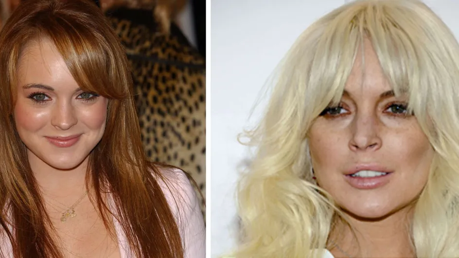 Lindsay Lohan et la chirurgie esthétique : Son avant/après ! (Photos)