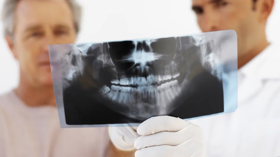 Cancer : Limitez les radiographies dentaires !
