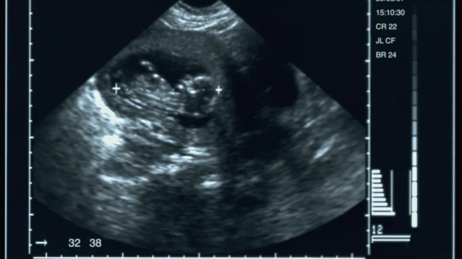 Avortement : « L’échographie ne fera pas changer d’avis la patiente » (Exclu)