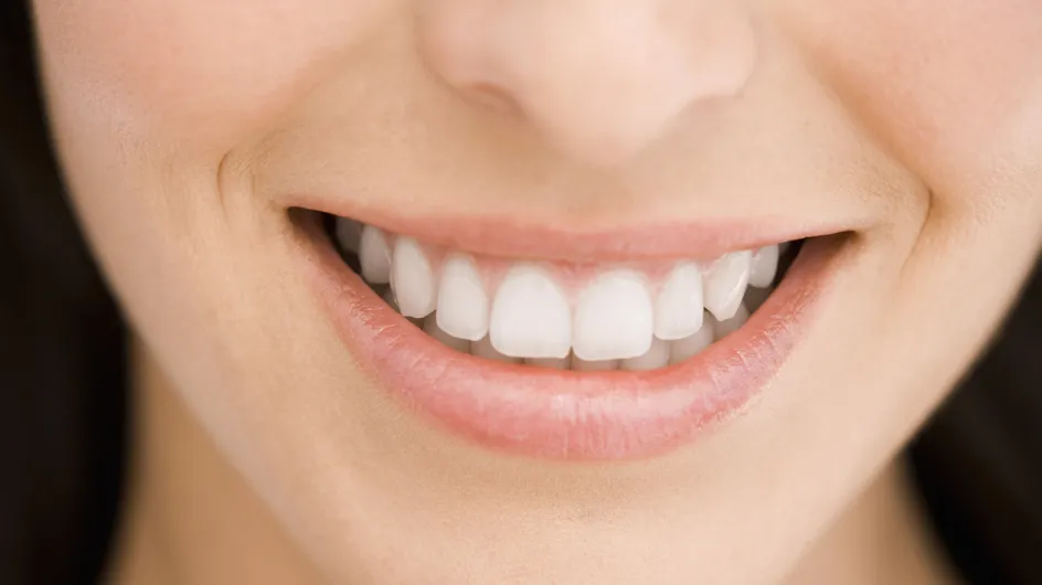 Bars à sourire : Il ne font pas rire les dentistes