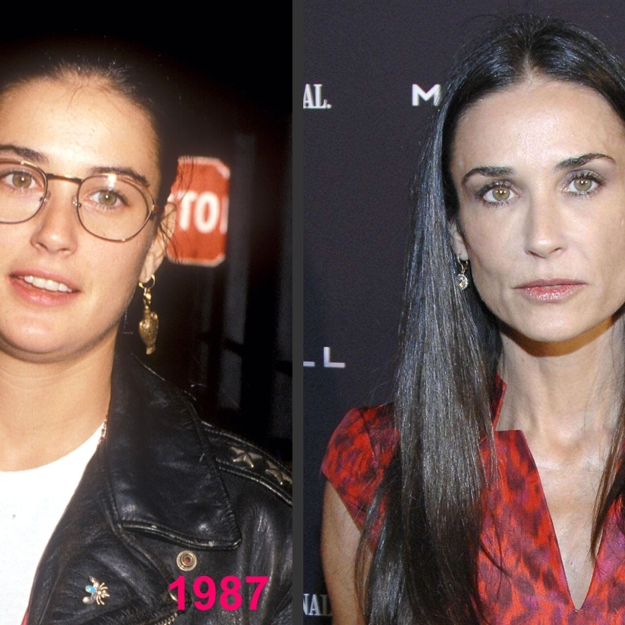 Demi Moore et la chirurgie esthétique : Son avant/après en photos