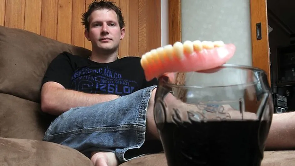 Santé : A 25 ans, il perd toutes ses dents suite à une surconsommation de soda