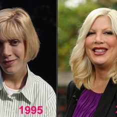 Tori Spelling et la chirurgie esthétique : Son avant/après en photos