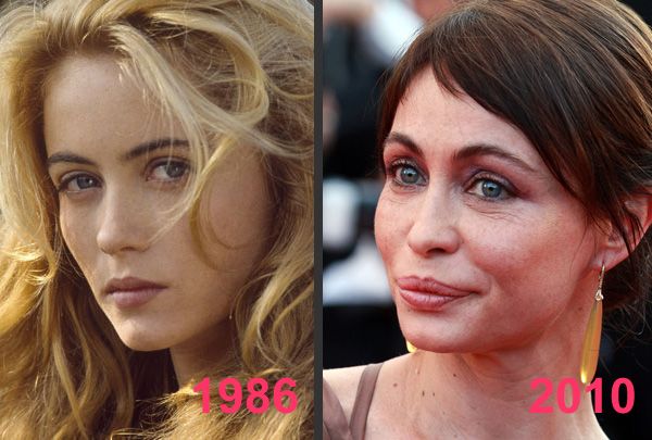 RÃ©sultat de recherche d'images pour "images avant aprÃ¨s emmanuelle beart"