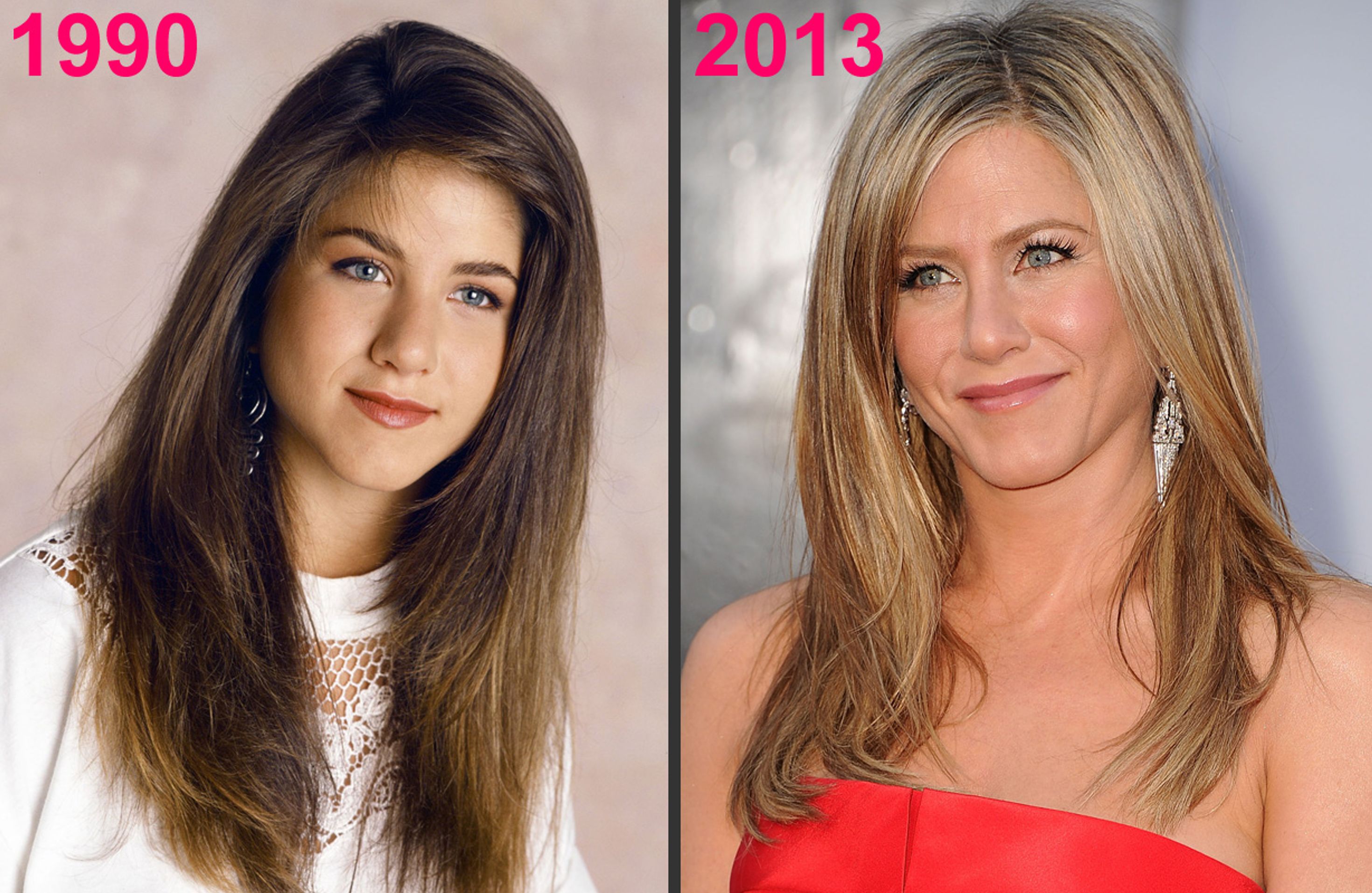 Jennifer Aniston Et La Chirurgie Esthétique Photos Avant Après