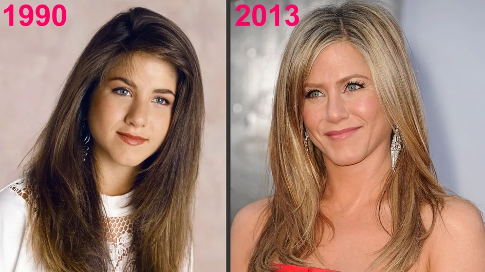 Jennifer Aniston et la chirurgie esthétique : Ses photos avant/après