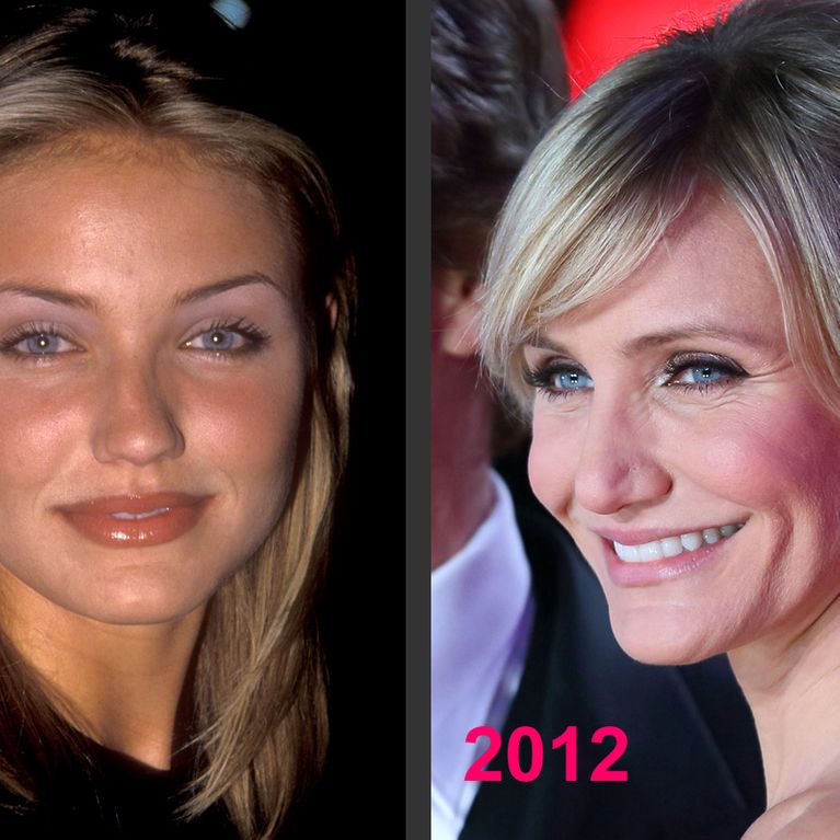 Cameron Diaz et la chirurgie esthétique Ses photos avant/après