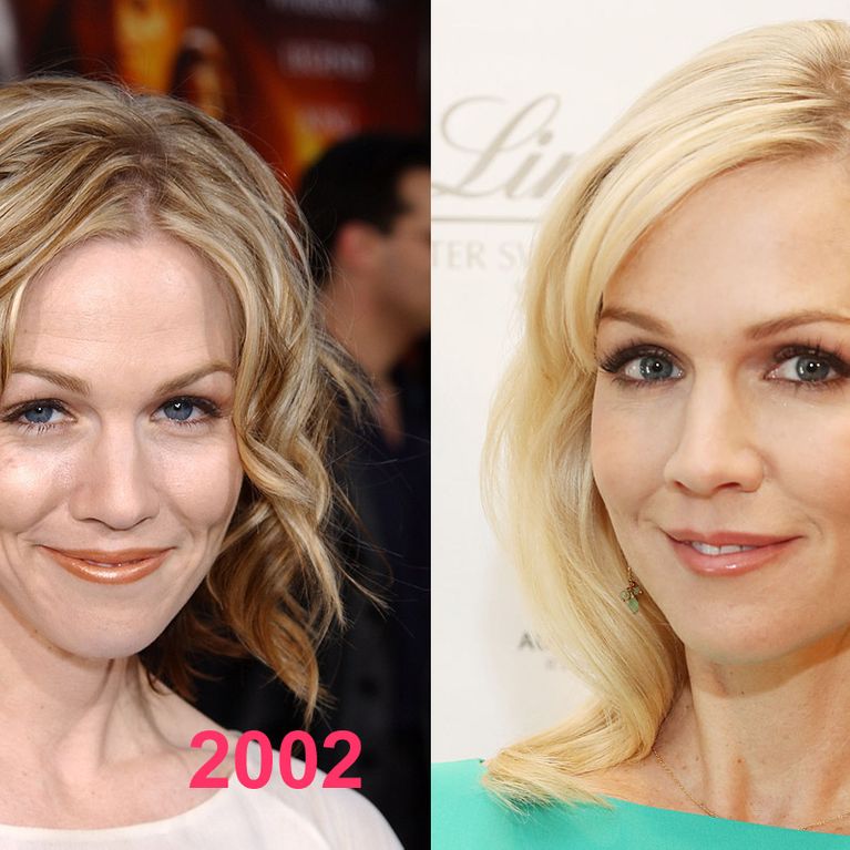 Jennie Garth et la chirurgie esthétique Son avant/après en photos