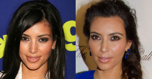Kim Kardashian Avant Chirurgie Les Anges Kim Kardashian : Son avant / après chirurgie esthétique