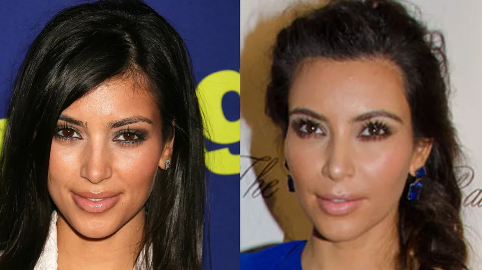 Kim Kardashian : Son avant/après chirurgie esthétique (Photos)