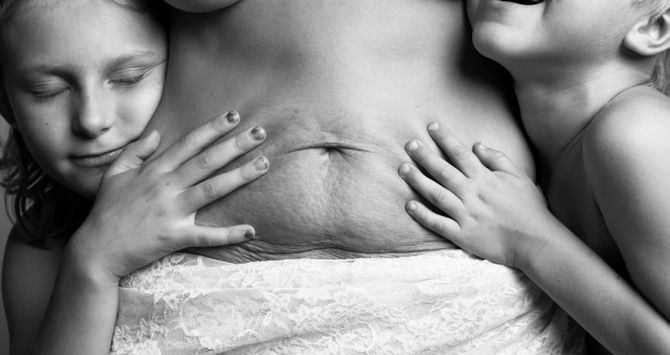 Niñas abrazadas a un vientre