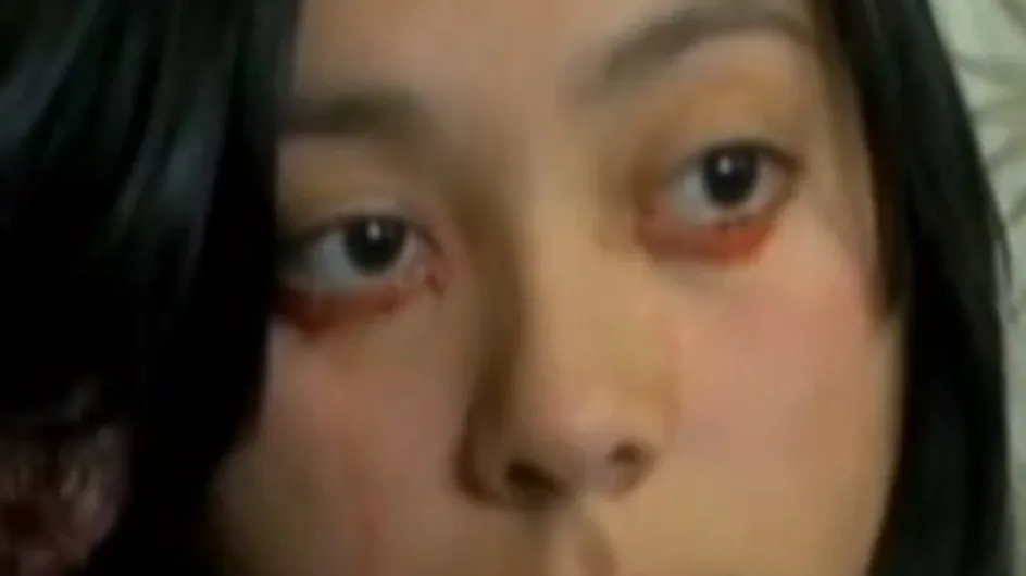 Une jeune femme pleure des larmes de sang (Vidéo)