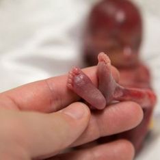 Las impactantes fotos de un bebé de 19 semanas reabren el debate sobre el aborto