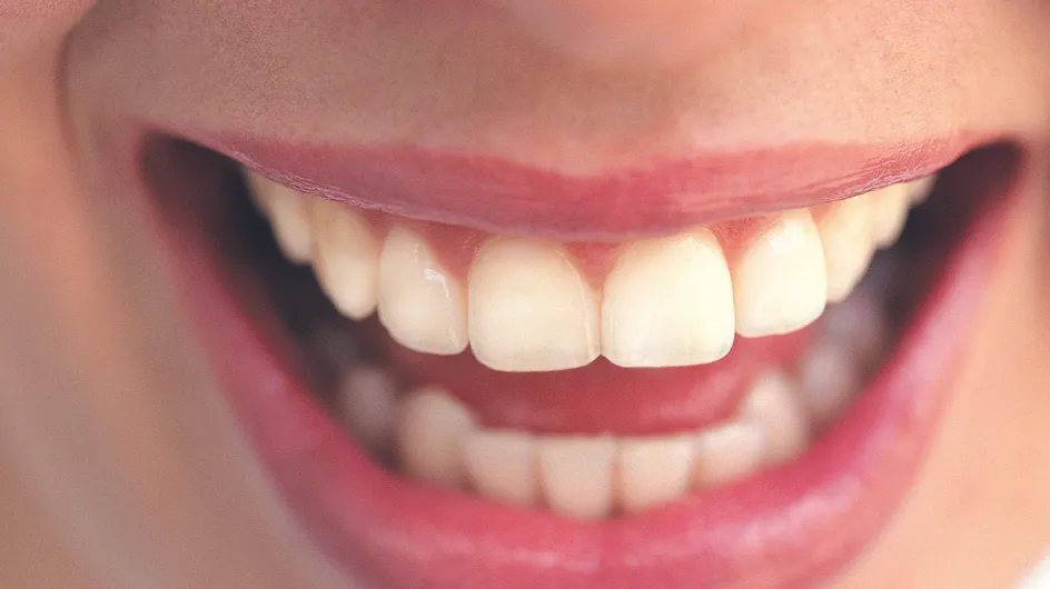 Blanchiment des dents : Un encadrement plus strict