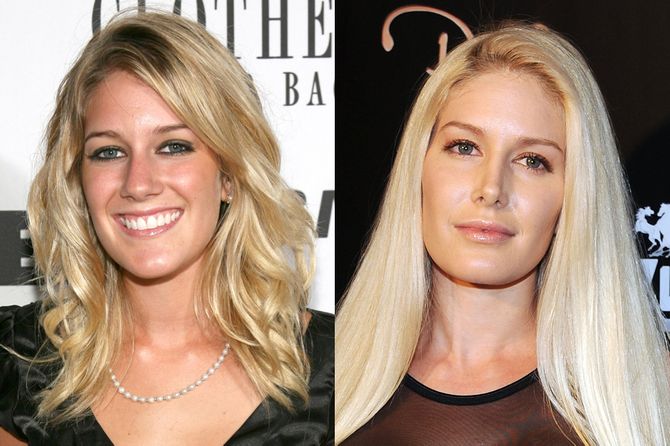 Heidi Montag