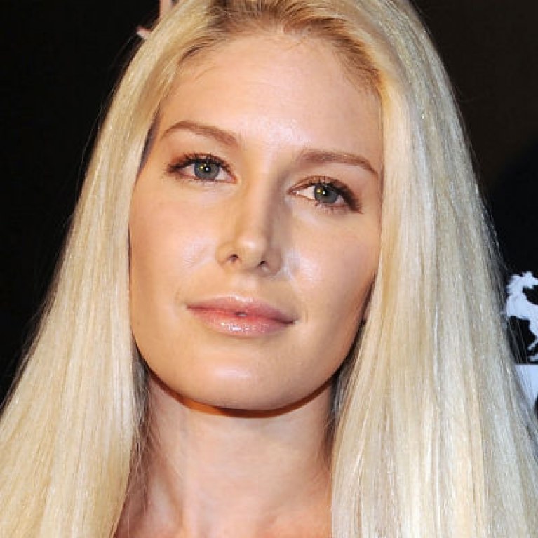 Heidi Montag Decreased Her Bowling Ball Breasts To New Reduced C Cups 8654