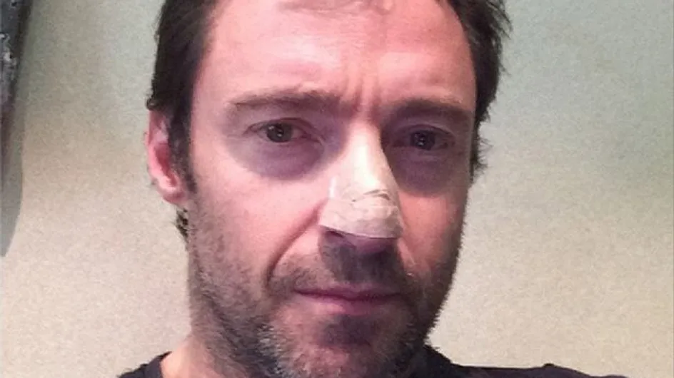 Hugh Jackman has been treated for skin cancer