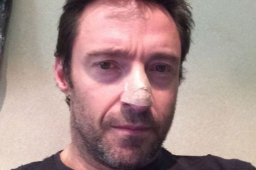 Hugh Jackman