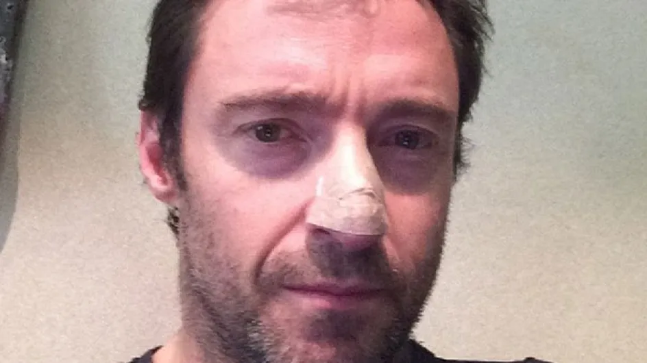 Hugh Jackman confiesa en Twitter que sufre cáncer de piel