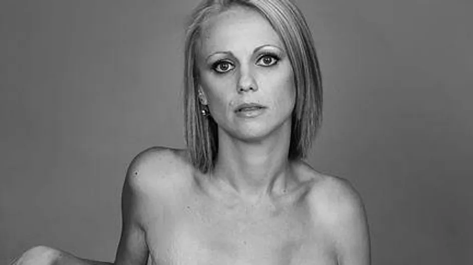 Cancer du sein : Elle pose et expose ses cicatrices sur Facebook (photos)