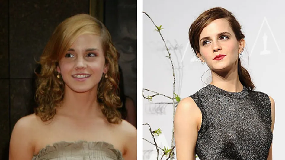 Emma Watson : Son incroyable évolution look au fil des ans ! (Photos)