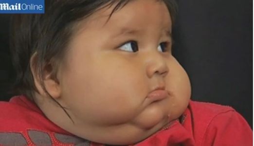 A 8 Mois Ce Bebe Pese Kilos Soit Pres De 3 Fois Plus Que La Normale
