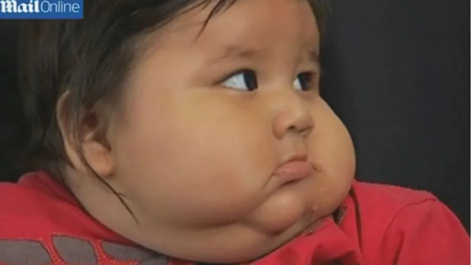 À 8 mois ce bébé pèse 20 kilos… soit 3 fois plus que la normale