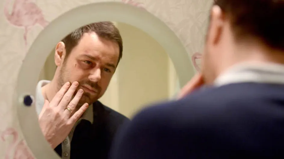 Eastenders 31/03 – Mick’s family question him about his bruised face