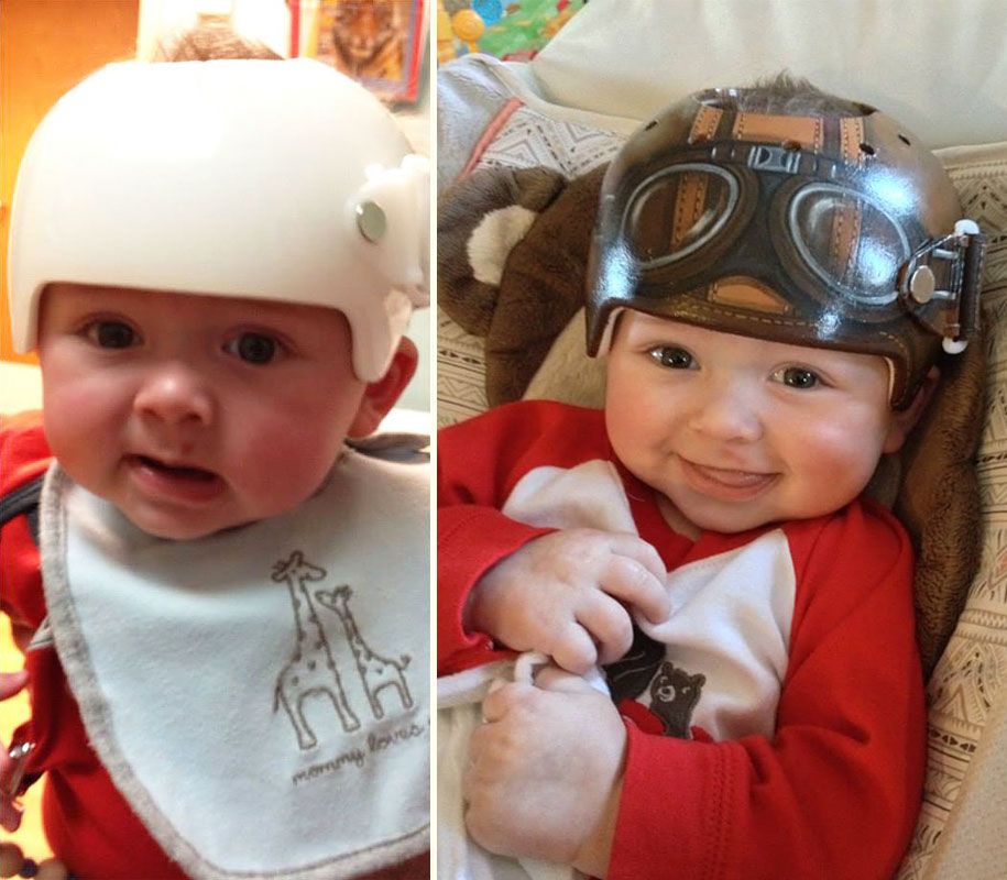 Une Artiste Transforme Des Casques Medicaux De Bebes En Veritables œuvres D Art