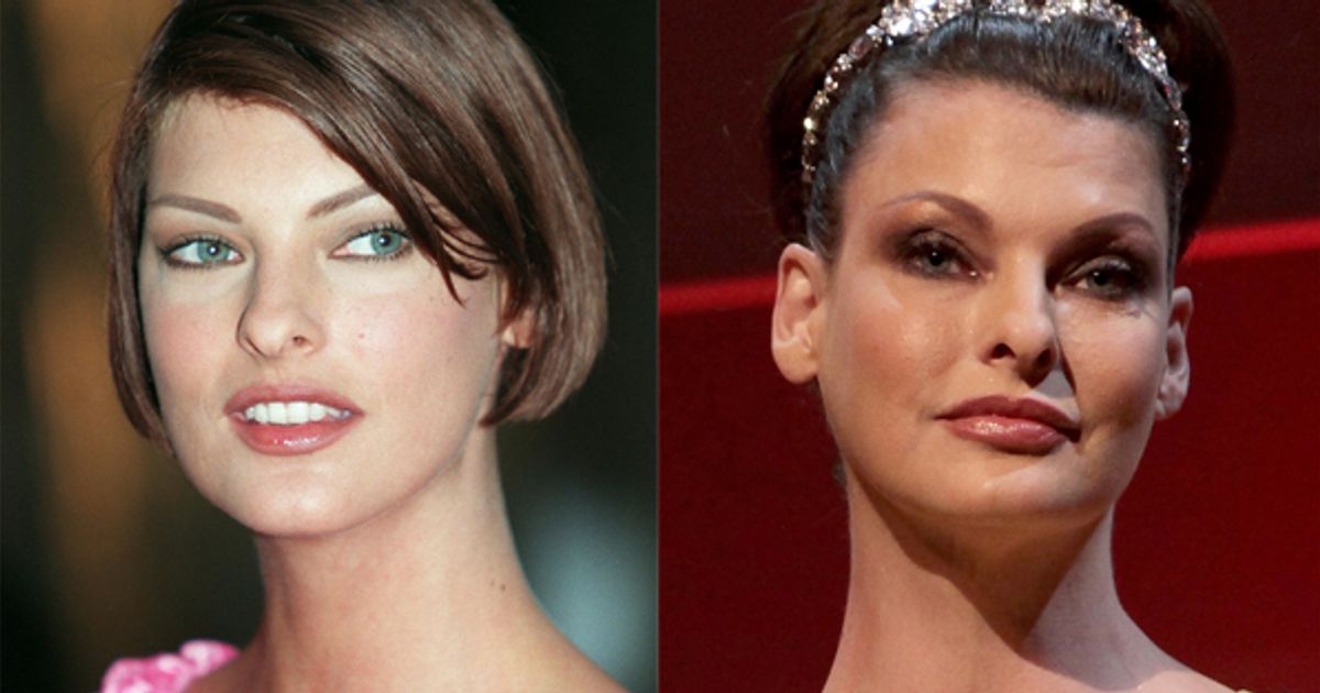 Linda Evangelista Son Effrayant Avant Apres Chirurgie Esthetique