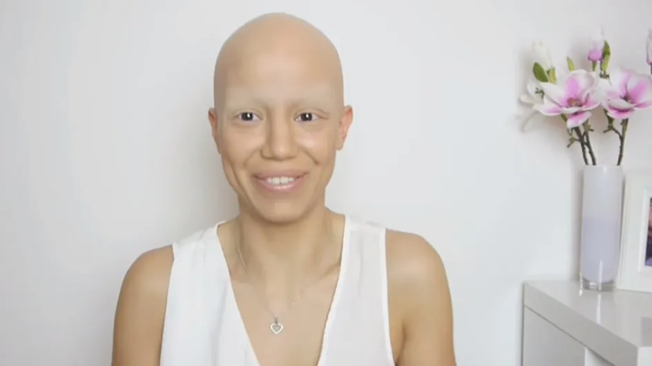 Cette jeune femme souffre de la pelade mais n'a pas abandonné sa féminité pour autant (Vidéo et photos)