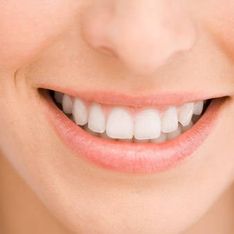 Consejos para tener los dientes blancos