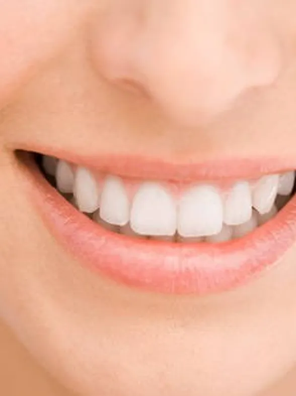 Consejos para tener los dientes blancos
