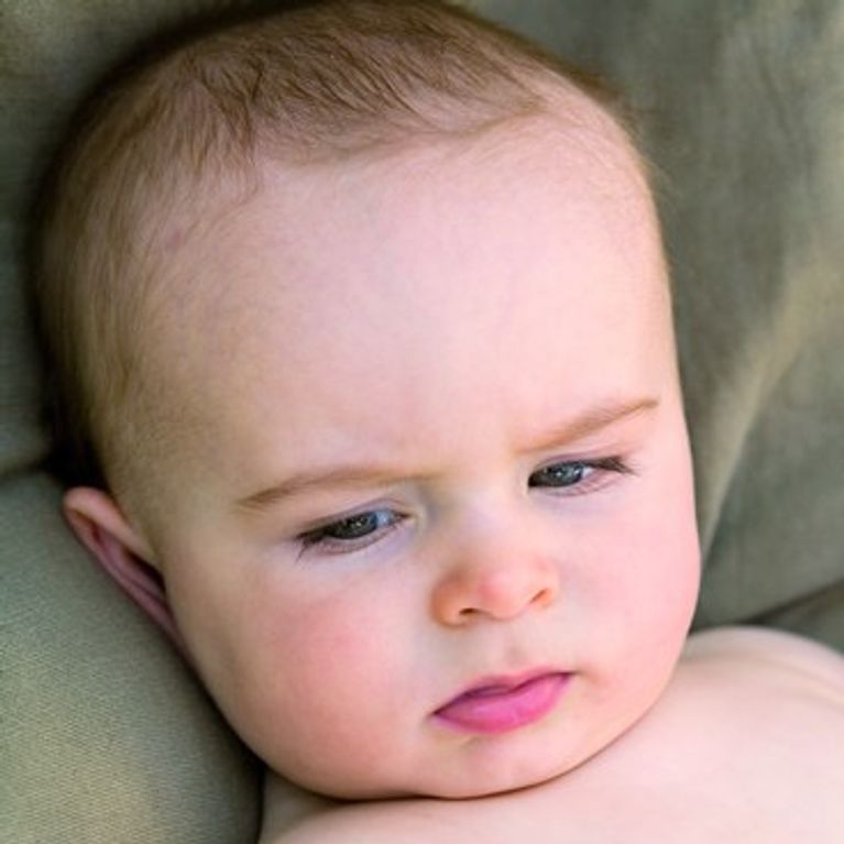 Que es la circuncision en bebes