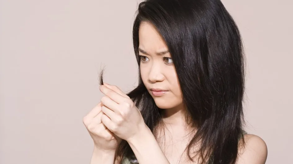 La pérdida del cabello también preocupa a las mujeres