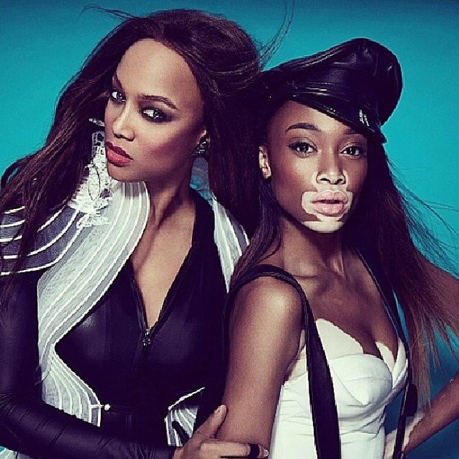 Winnie Harlow e Tyra Banks