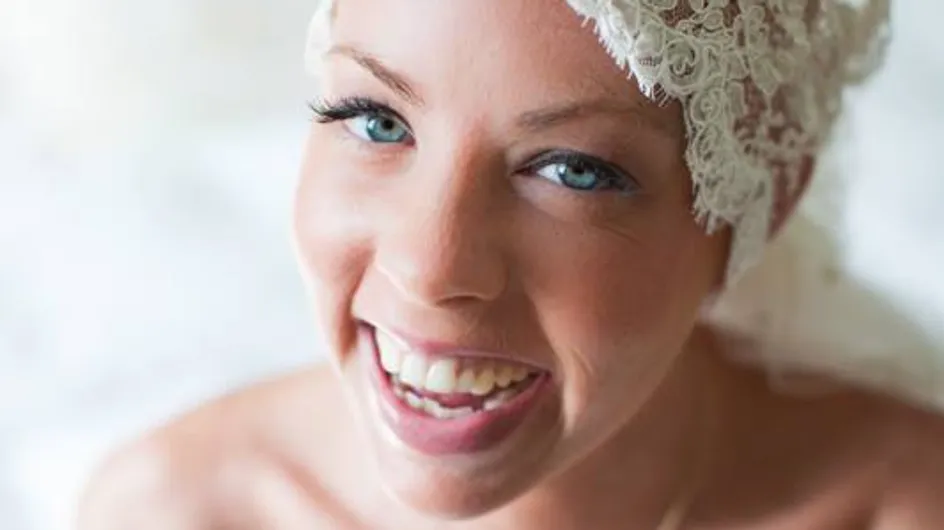 La mariée sans cheveux : Malgré son cancer, cette jeune femme a vécu le plus beau jour de sa vie