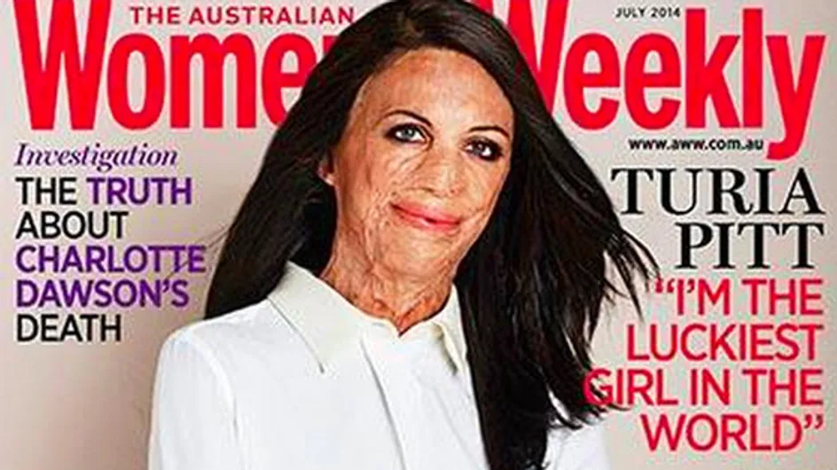 Turia Pitt, grande brûlée, en couverture d'un magazine féminin australien