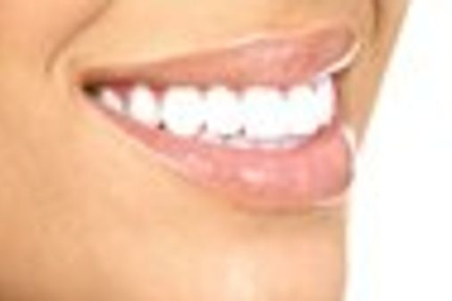 Teeth Whitening