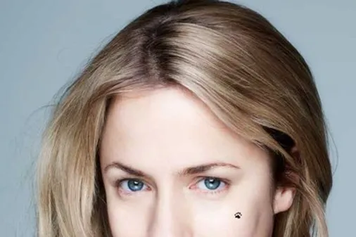 Celebrities without makeup: Caroline Flack and other stars go "BearFaced" for charity