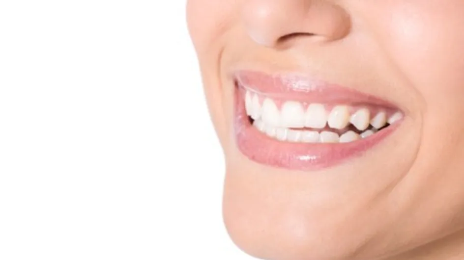 Tips voor stralend witte tanden