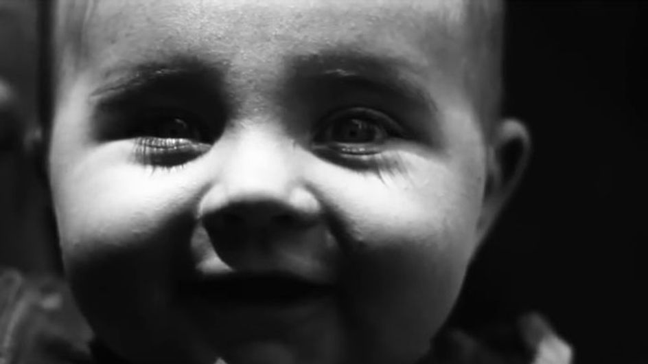 ¡OJO! Así es tu piel bajo la mirada del sol