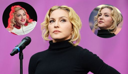 Botox-Opfer? Madonna, was ist mit deinem Gesicht los?