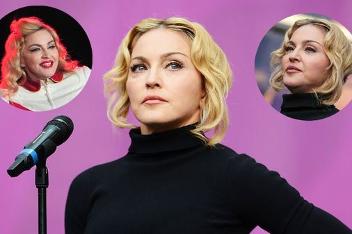 Botox-Opfer? Madonna, was ist mit deinem Gesicht los?